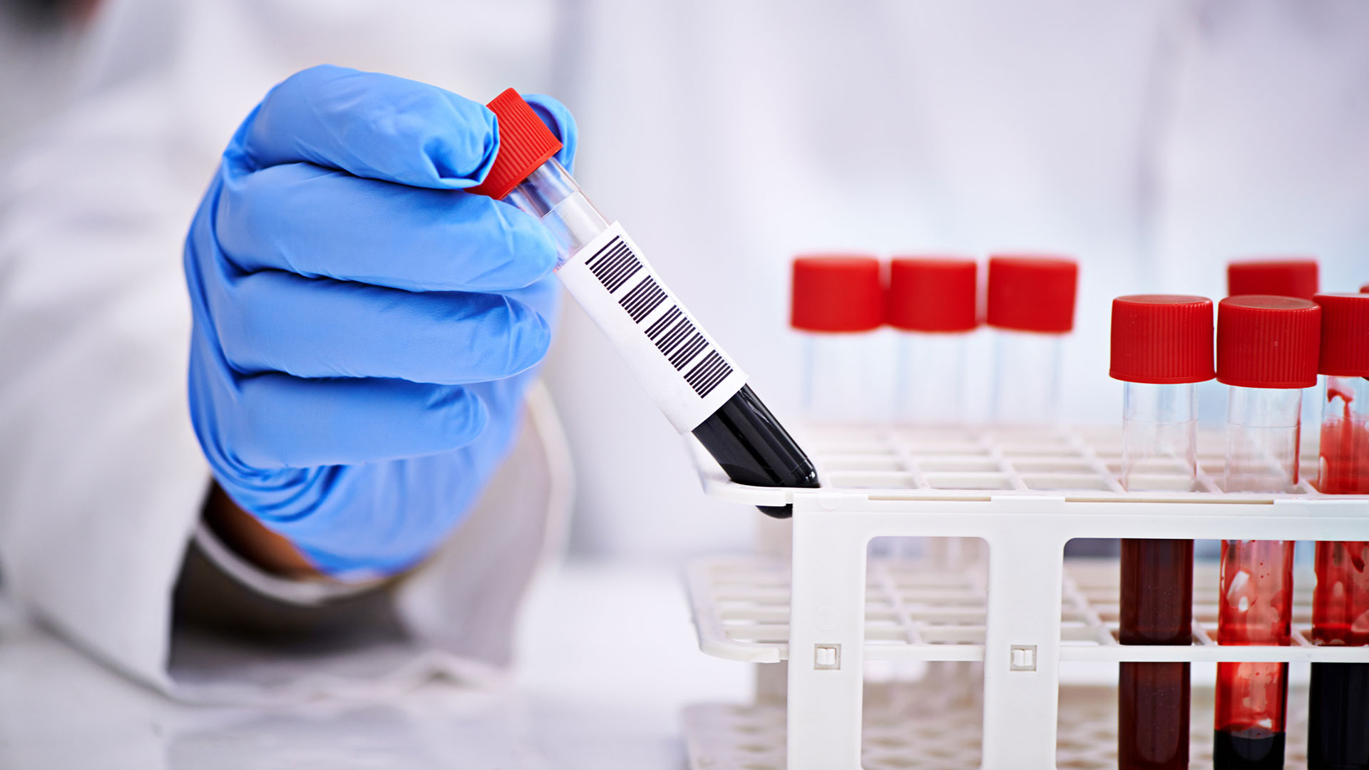 Digital Pathology and the Future of Medical Diagnosis